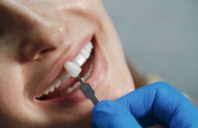 স্মাইল ডেন্টাল কেয়ারে চিকিৎসার পর খুশি রোগীর হাসি